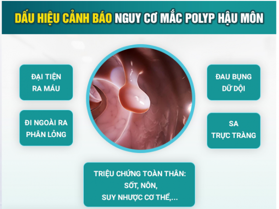 polyp hậu môn dấu hiệu.png